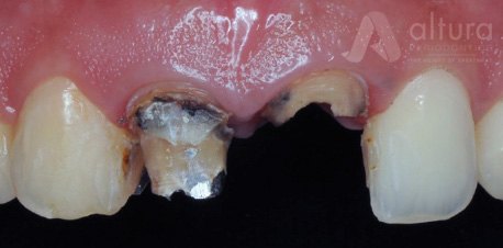 Dental Cases Before & After 101